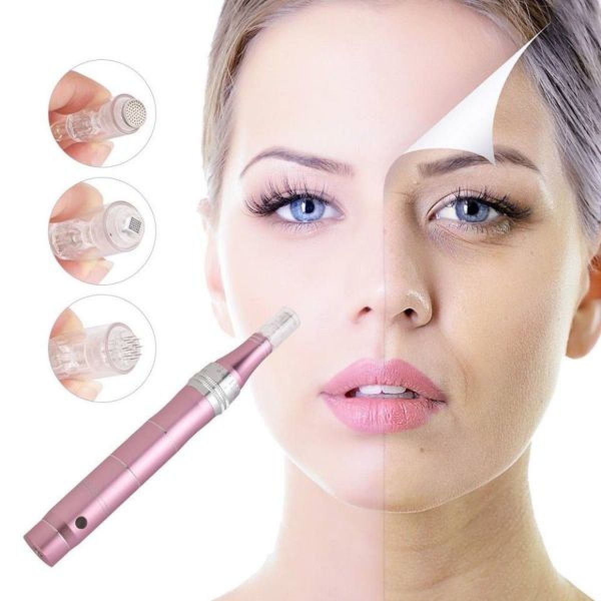 formation microneedling